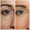 OPENEYES Wallen crème | 1 + 1 GRATIS