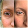 OPENEYES Wallen crème | 1 + 1 GRATIS