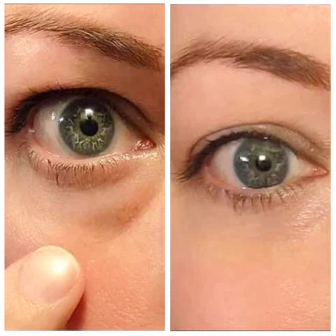 OPENEYES Wallen crème | 1 + 1 GRATIS