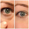 OPENEYES Wallen crème | 1 + 1 GRATIS